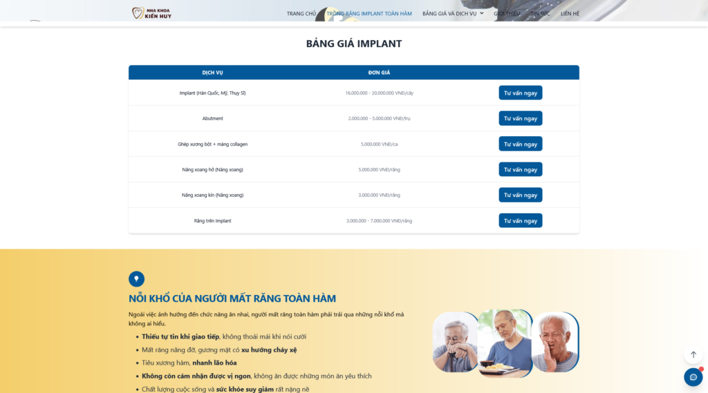 BẢNG GIÁ IMPLANT